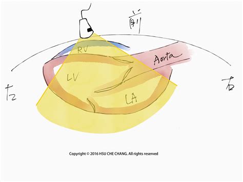 探頭圖|探頭使用手法介紹 – POCUS Academy